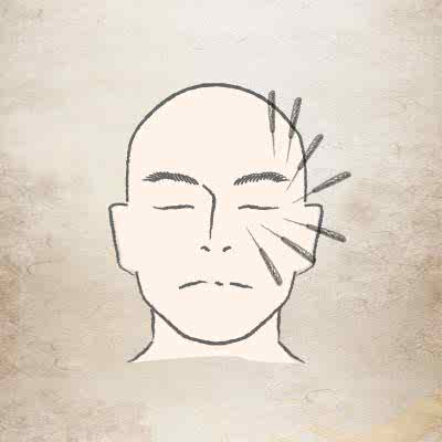 美顏針
